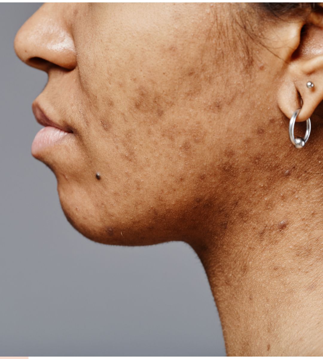 ILOn tuotteet auringon vaurioittamalle iholle korjaavat, kosteuttavat ja vahvistavat ihoa antioksidanttien ja probioottien avulla. Palauta hehku ja suojaa iho luonnollisesti.